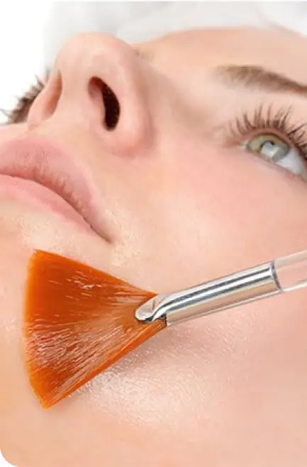 Peeling rinnovatore all’acido glicolico